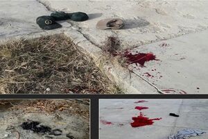 اسامی مجروحان حادثه تروریستی نیکشهر مشخص شد