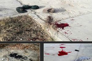 اسامی مجروحان حادثه تروریستی نیکشهر مشخص شد