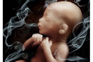 ۳۲.۶ درصد زنان باردار در معرض دود دست‌دوم سیگار قرار دارند