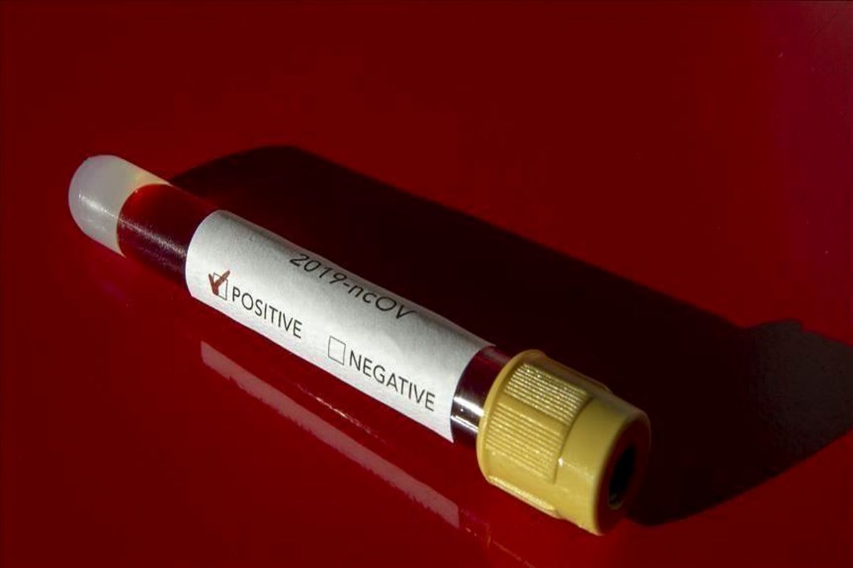 شیوع کرونا در قطر