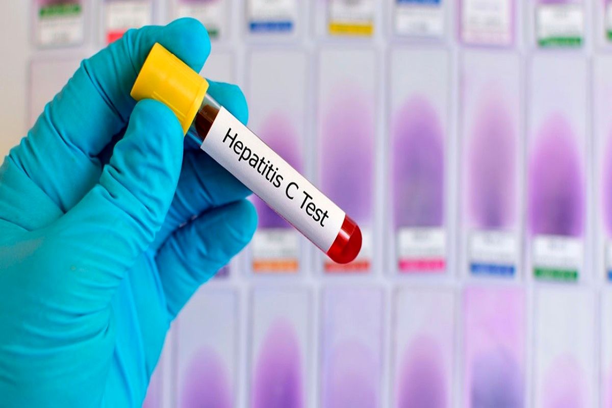 هپاتیت C