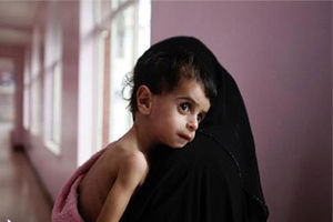 200 میلیون کودکِ زیر 5 سال از سوتغذیه رنج می برند