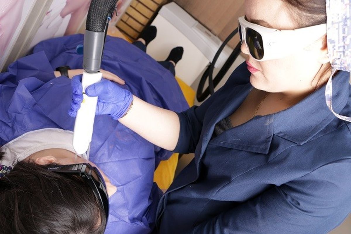 لیزر موهای زائد