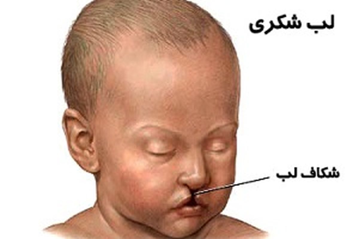  ناهنجاری‌های حاد صورت 