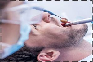 معرفی 5 برند ایرانی و خارجی سیلر برای پر کردن ریشه دندان