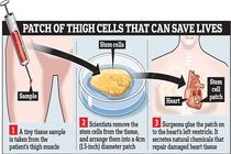 درمان نارسایی قلبی با روشی نوین