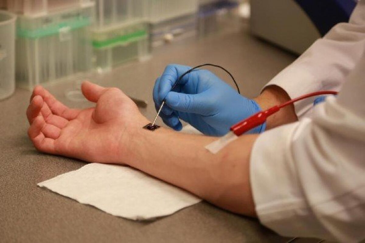 زخم دست
