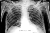 طرح تولید فیلم رادیولوژی در گیلان ارائه می شود