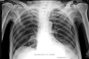 طرح تولید فیلم رادیولوژی در گیلان ارائه می شود