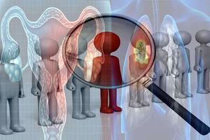 ۳۶۰۰ بیمار مبتلا به سرطان در مشهد شناسایی شدند