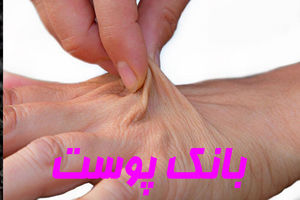 خراسان رضوی دارای تنها بانک اختصاصی و فعال پوست کشور