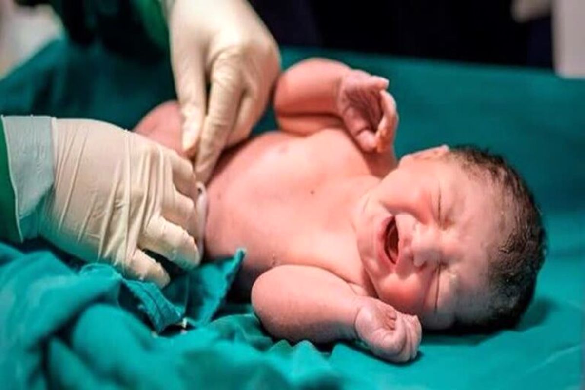 زایمان موفق با روش IUI