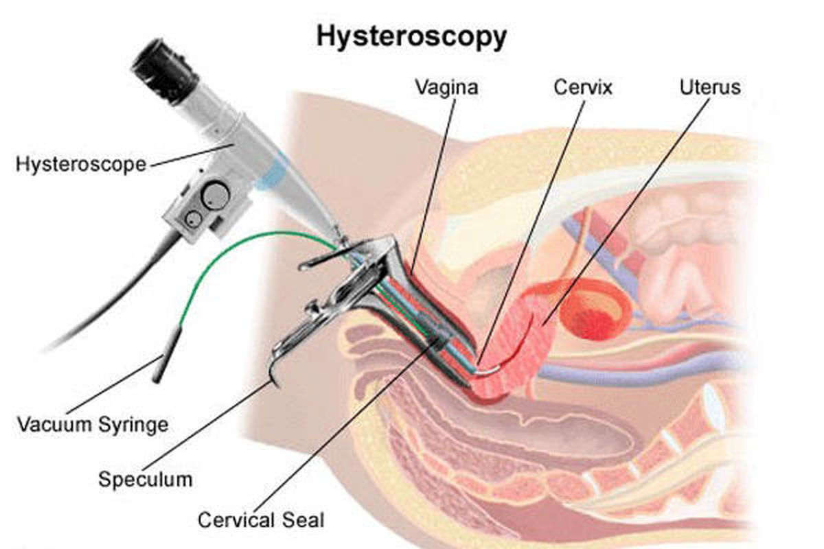 عکس رنگی از رحم6