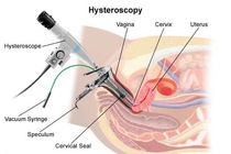 عکس رنگی رحم چیست؟/ به چه دلیل عکس رنگی از رحم  تجویز می شود؟