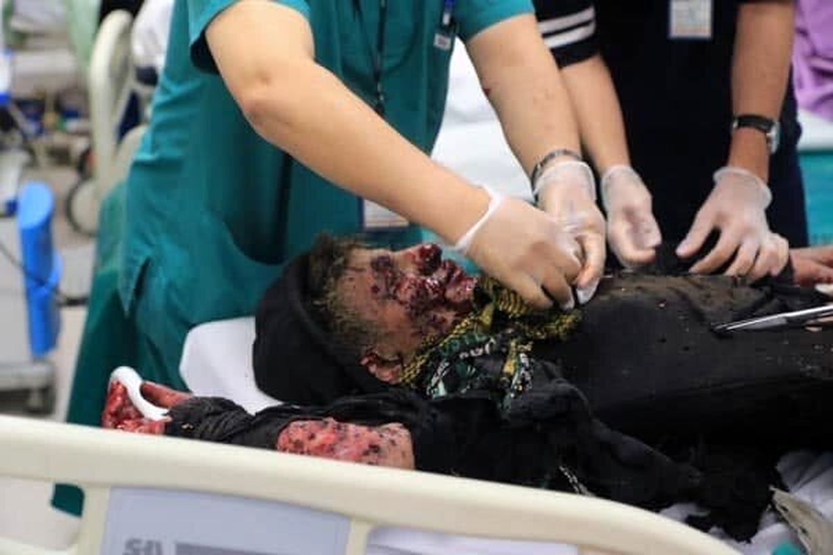 مصدومیت  آیین چهارشنبه سوری درگیلان 