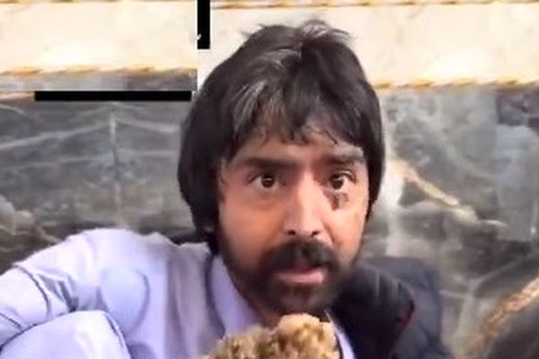 هوش مصنوعی ماجرای مرد درختی را تغییر داد