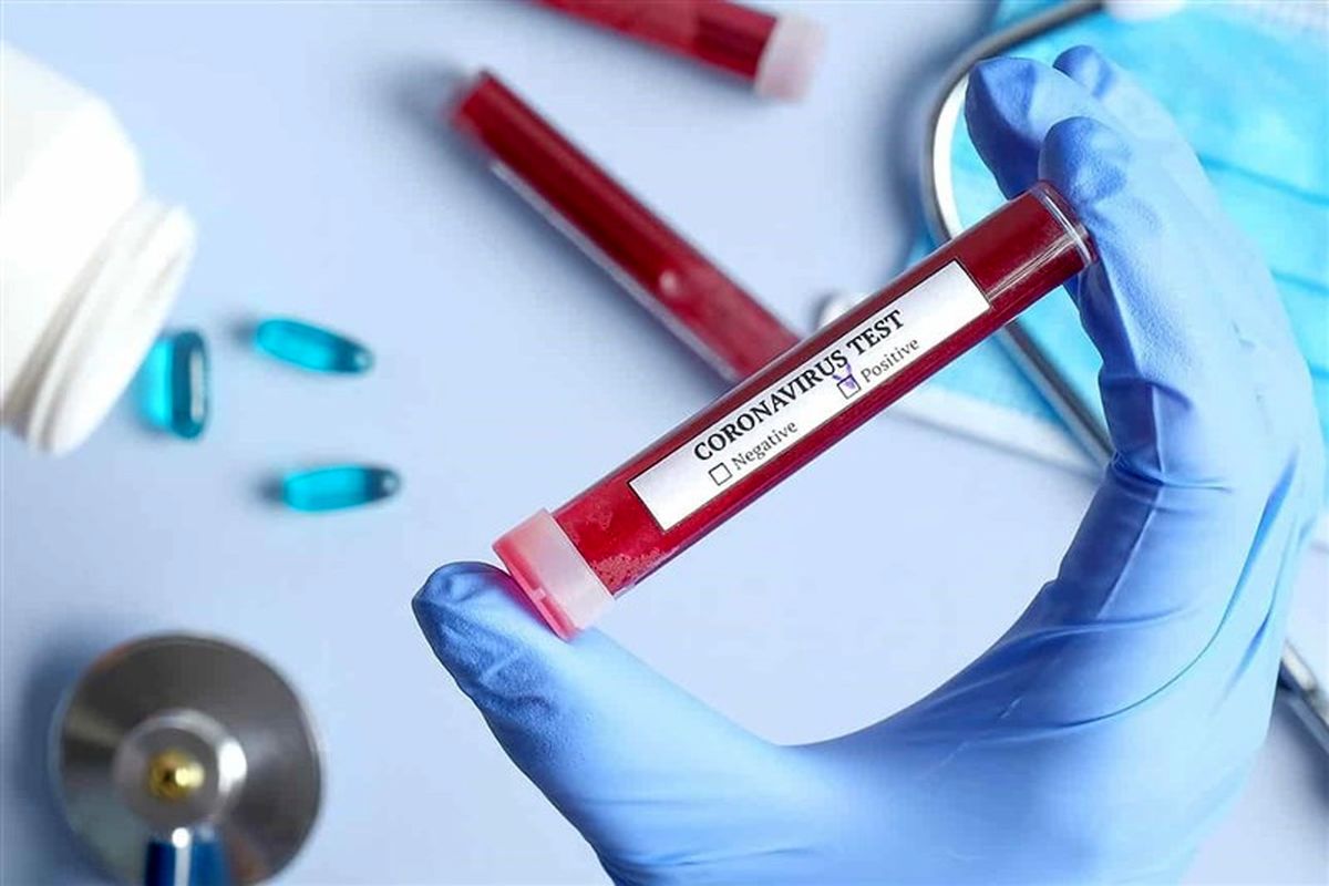  تست کرونا 