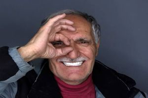 پرداخت هزینه ایمپلنت دندان؛ هدیه روز پدر!